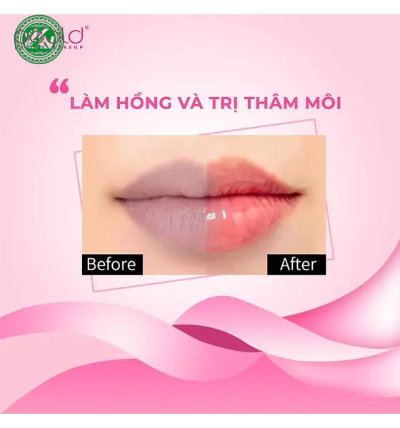 Son dưỡng Deol